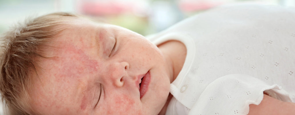 10 Strategic Steps to Pinpoint the Underlying Cause(s) of Baby Skin Irritations